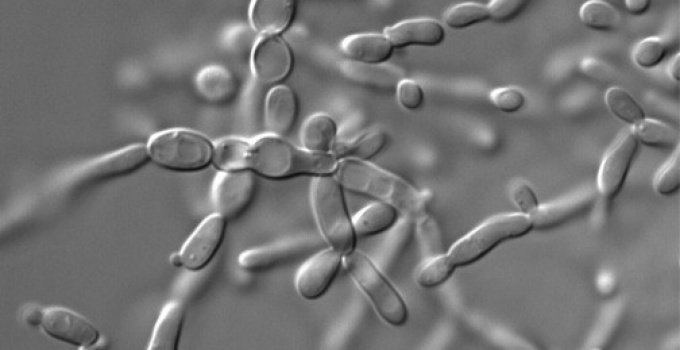 Saccharomyces cerevisiae. Image courtesy of Dr. Paul Cullen. 