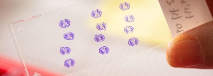 A hand holds a glass microscope slide with multiple small purple-stained biological samples arranged in rows. The slide is labeled and backlit, with laboratory slides and equipment visible in the background. 