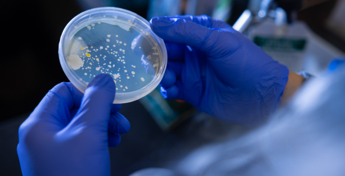 Gloved hands hold a petri dish containing bacterial colonies growing on agar, viewed close up in a biology laboratory. 
