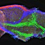 View of auditory nerve fibers (green) entering the cochlear nucleus (blue and red) (from Chanda et al., 2011). 