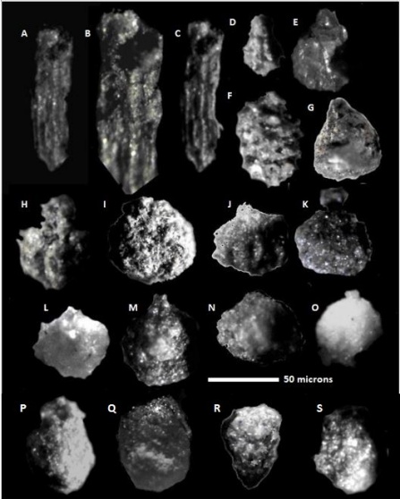 Zoom image: Images of freshwater Characae algae reproductive organs (e.g., oogonia and antheridia) and algae plant portions (e.g., stipules, branchlets) 