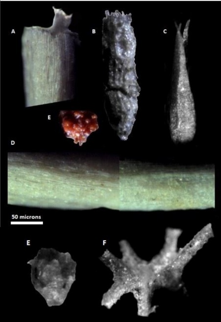 Zoom image: Images of freshwater Characae algae reproductive organs (e.g., oogonia and antheridia) and algae plant portions (e.g., stipules, branchlets) 