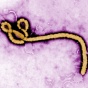An Ebola virus virion, captured in a colorized transmission electron microscope image. 