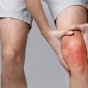 Person grabbing their inflamed knee. 