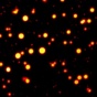 CAG-repeat RNA droplets are shown as glowing orange dots on a black background, at a microscopic level. 