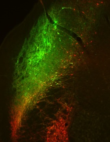 Immunofluorescent staining identifying two distinct populations of neurons, from the Neurobiology of Habitual Behaviors Laboratory. 