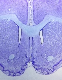 Thionin-stained coronal section of a rodent brain, from the Neurobiology of Habitual Behaviors Laboratory. 