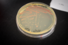 A petri dish holds streaks of yeast cells, with some individual yeast colonies (the small dots) visible. The cells and colonies have turned a bubblegum pink after students used CRISPR successfully to break a gene called ADE2. 