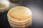 A stack of petri dishes holds streaks of yeast cells that have turned pink after students used CRISPR successfully to break a gene called ADE2.